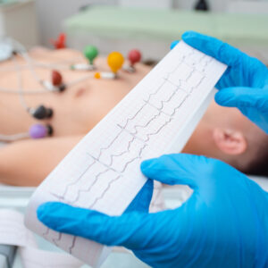 Modulo ECG